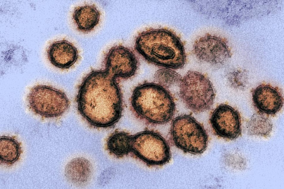 Het aantal besmettingen met het corona-virus lag zaterdag een stuk lager dan eerder in de week.