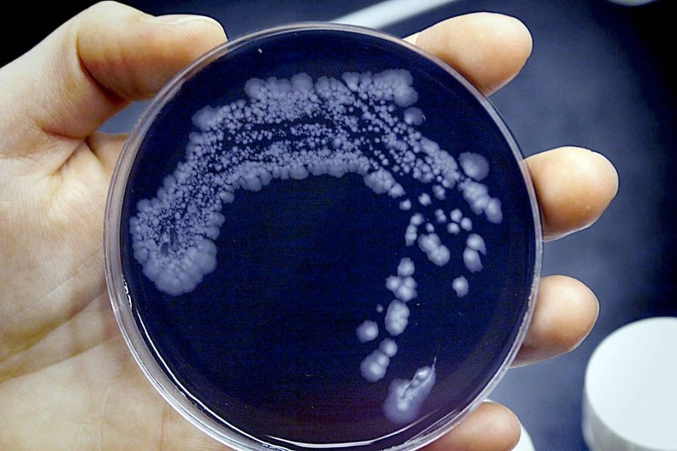 Het legionella bacterie. Foto: ANP